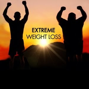 extreme weight loss